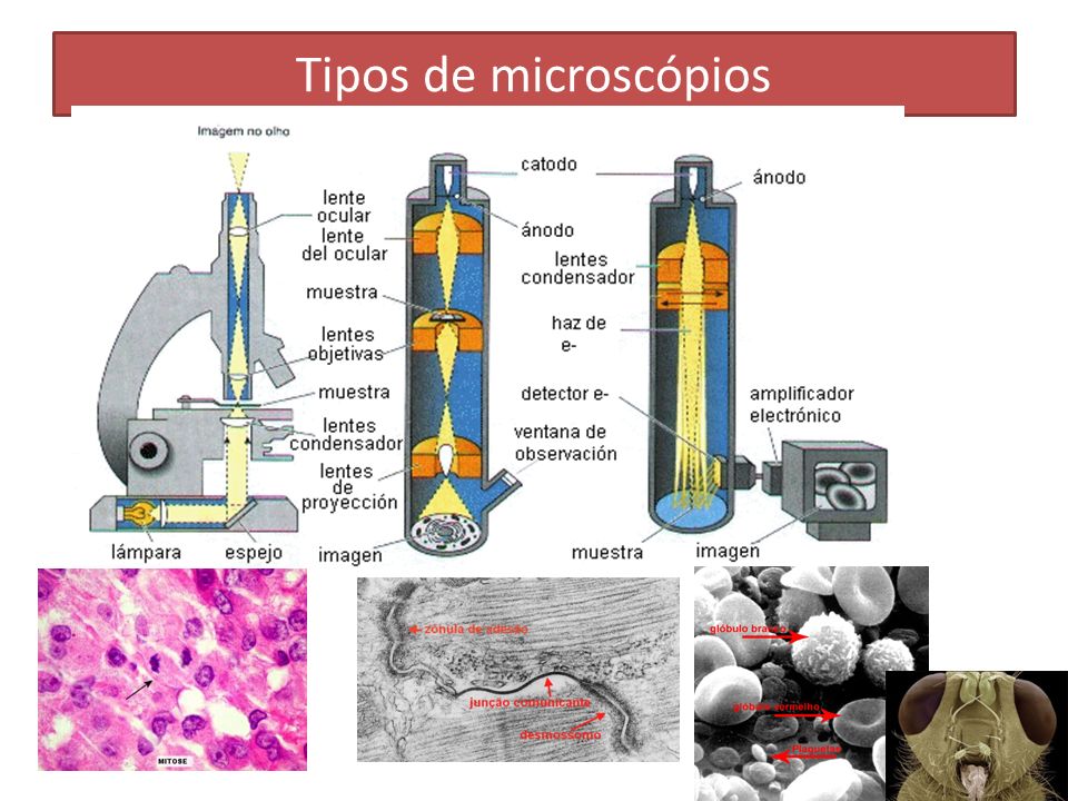 Tipos de microscópios