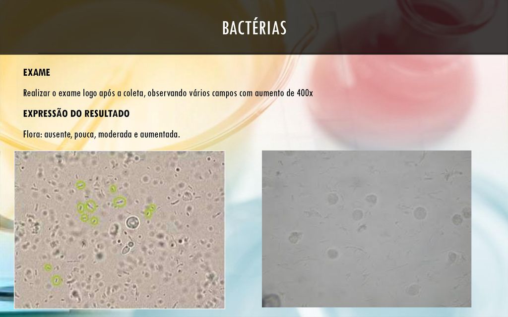 Sedimentoscopia bactérias, leveduras, parasitas e espermatozoides - ppt  carregar