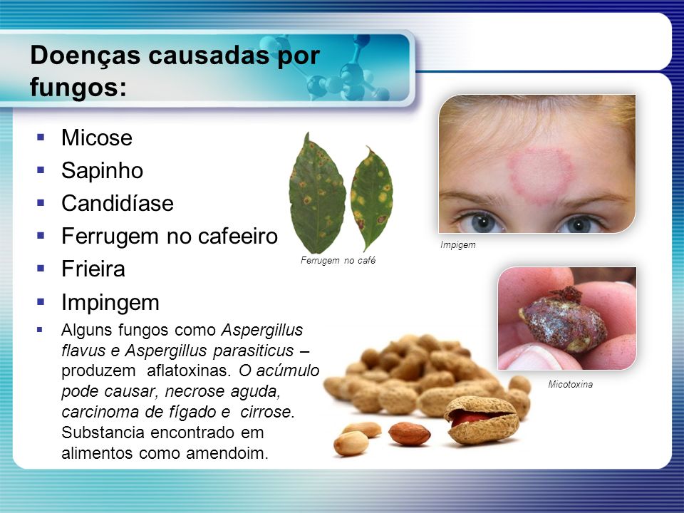 Doenças causadas por fungos: