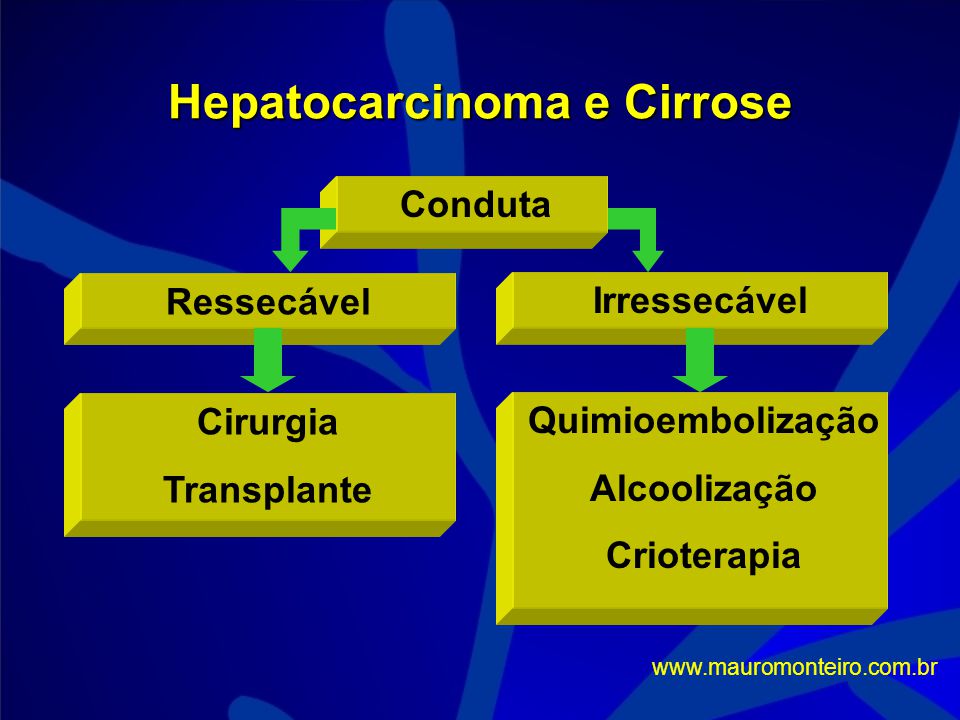 Hepatocarcinoma e Cirrose