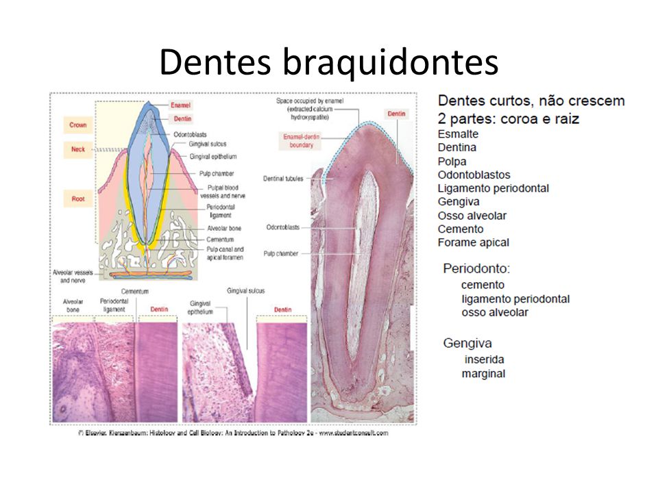 Dentes braquidontes