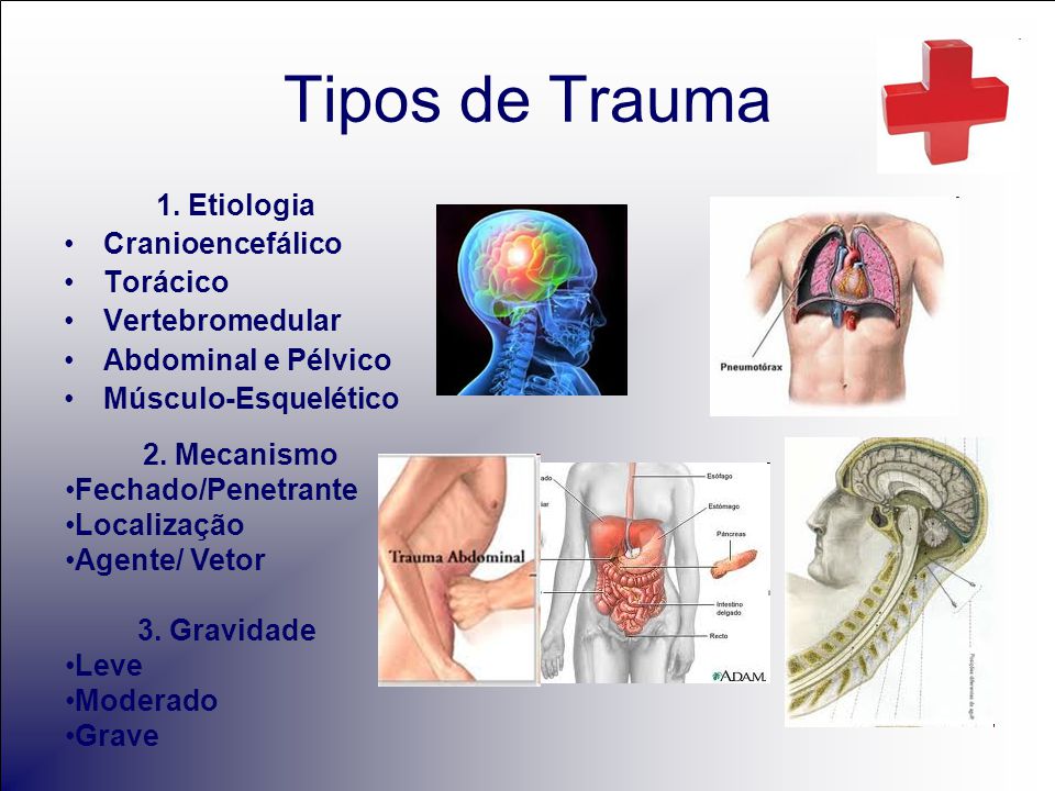 Tipos de Trauma 1. Etiologia Cranioencefálico Torácico Vertebromedular