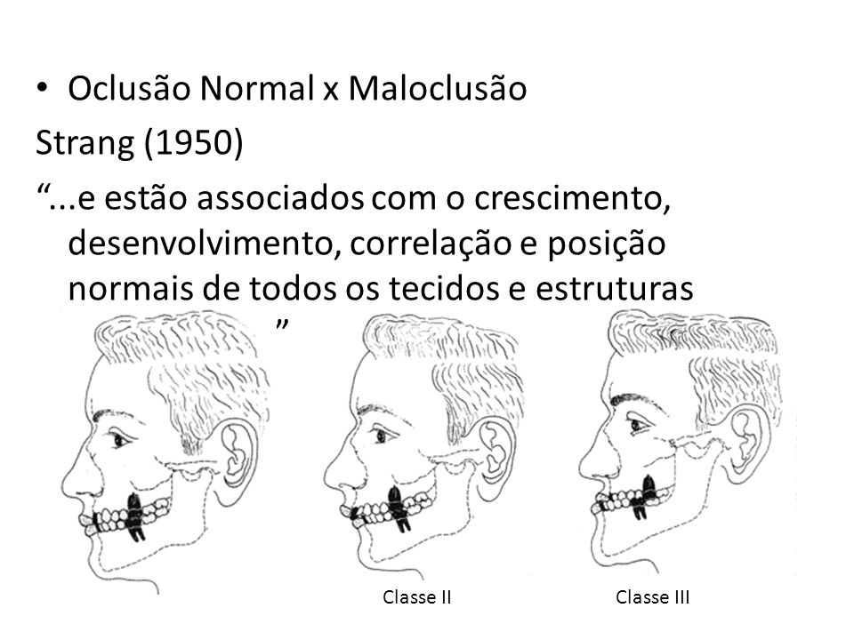 Oclusão Normal x Maloclusão Strang (1950)