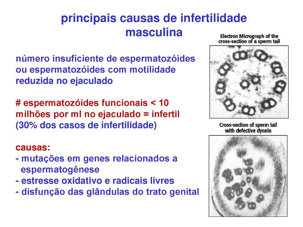 Fertilização E Fatores Que Contribuem à Infertilidade Ppt Carregar 7110