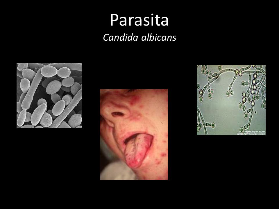 Parasita Candida albicans