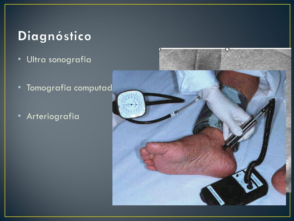 Diagnóstico Ultra sonografia Tomografia computadorizada Arteriografia