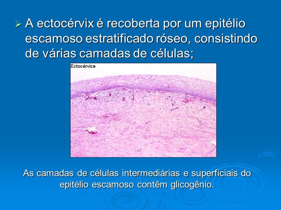 A ectocérvix é recoberta por um epitélio escamoso estratificado róseo, consistindo de várias camadas de células;