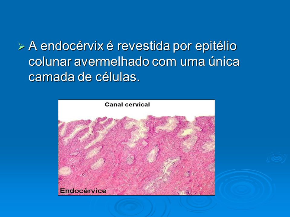 A endocérvix é revestida por epitélio colunar avermelhado com uma única camada de células.