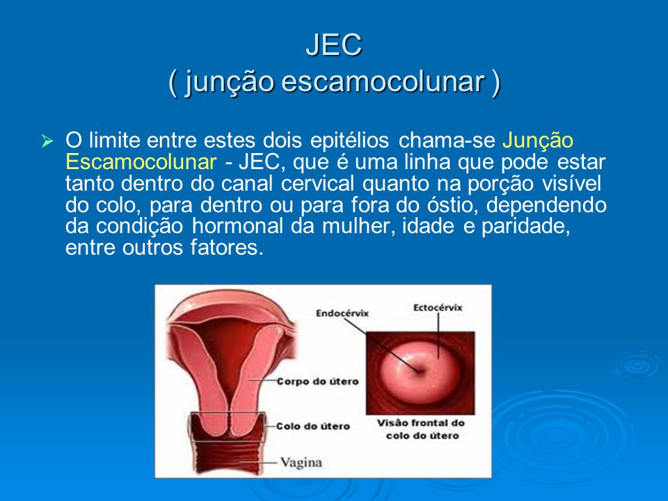 JEC ( junção escamocolunar )