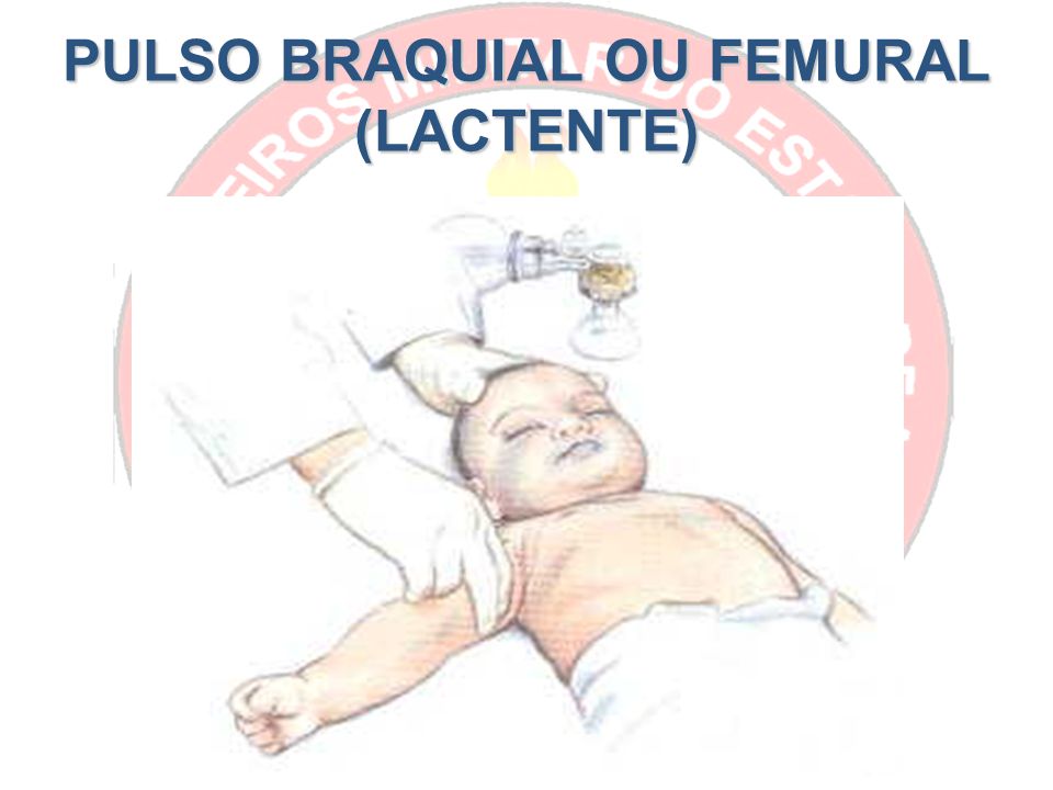 PULSO BRAQUIAL OU FEMURAL (LACTENTE)
