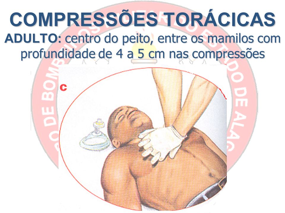 COMPRESSÕES TORÁCICAS ADULTO: centro do peito, entre os mamilos com profundidade de 4 a 5 cm nas compressões
