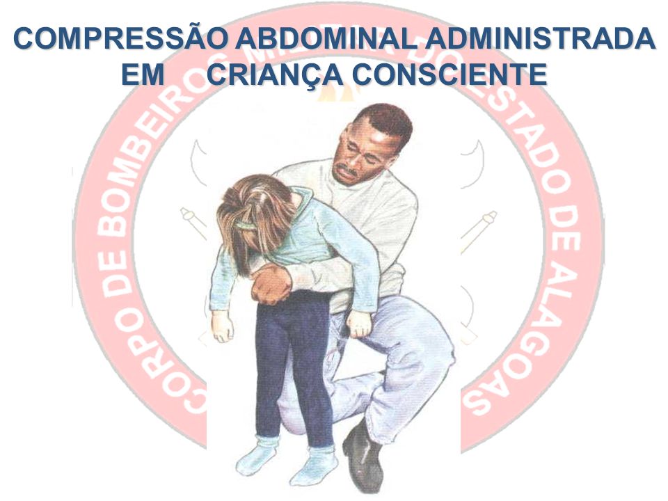 COMPRESSÃO ABDOMINAL ADMINISTRADA EM CRIANÇA CONSCIENTE