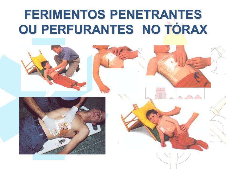 FERIMENTOS PENETRANTES OU PERFURANTES NO TÓRAX