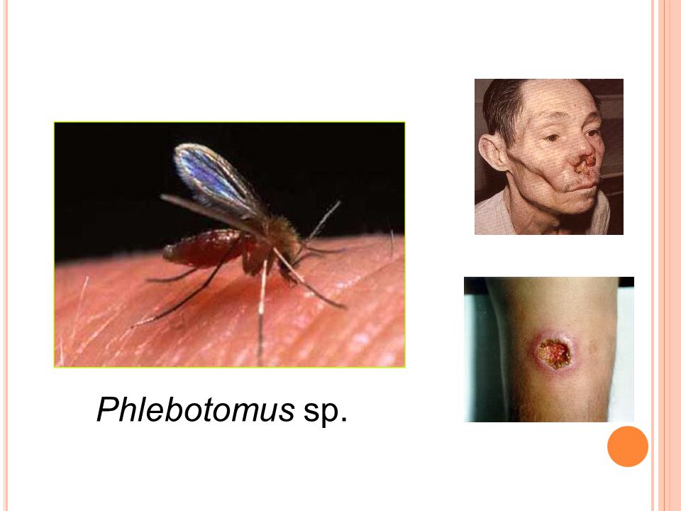Phlebotomus sp.