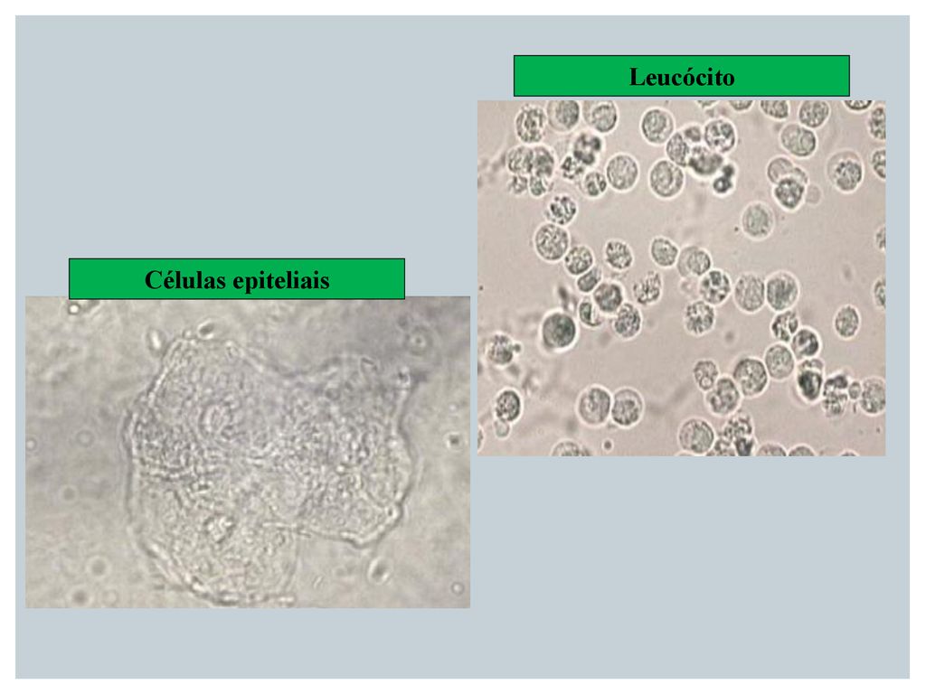Leucócito Células epiteliais
