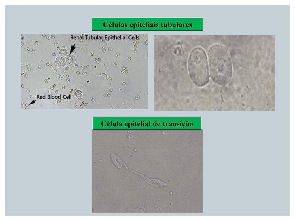 Células epiteliais tubulares Célula epitelial de transição