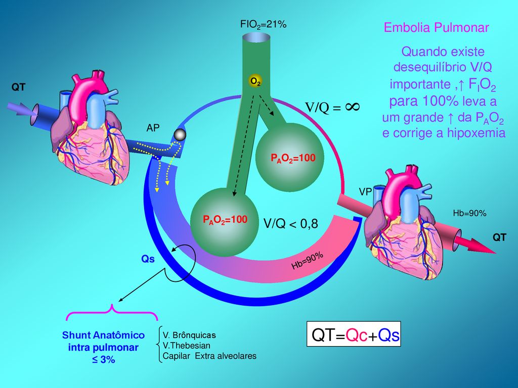 Quiz #95: Terapia Intensiva Neonatal e Pediátrica (TINP) - Somiti