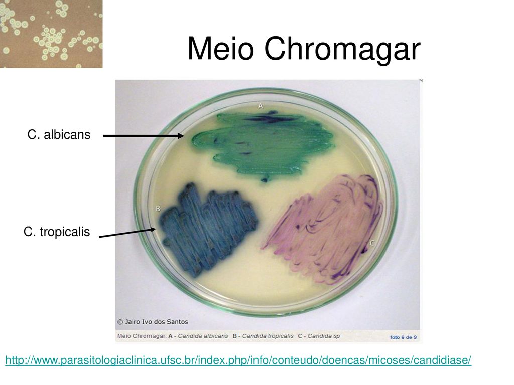 Micologia: leveduras patogênicas Candida spp e Cryptococcus neoformans -  ppt carregar