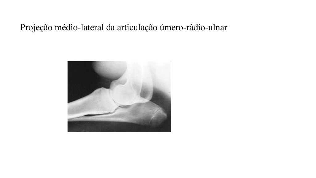 Projeção médio-lateral da articulação úmero-rádio-ulnar