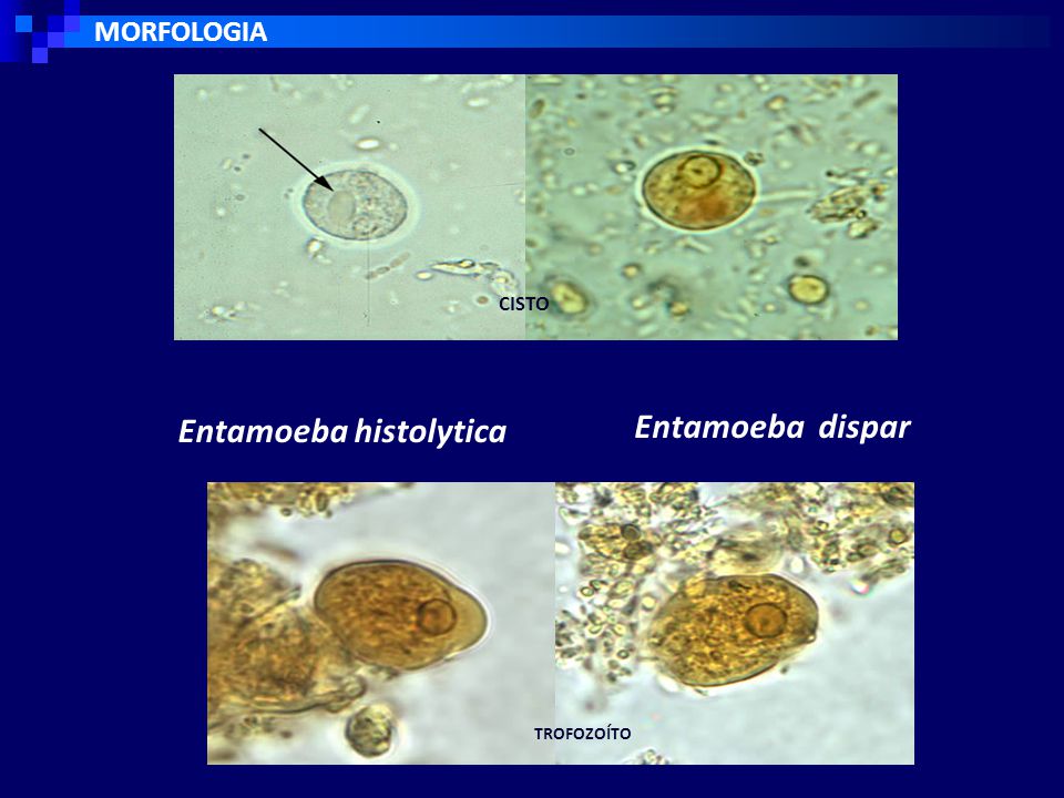 Entamoeba coli в кале. Entamoeba histolytica циста в Кале. Entamoeba histolytica под микроскопом. Циста амебы под микроскопом. Цисты лямблий микроскопия кала.