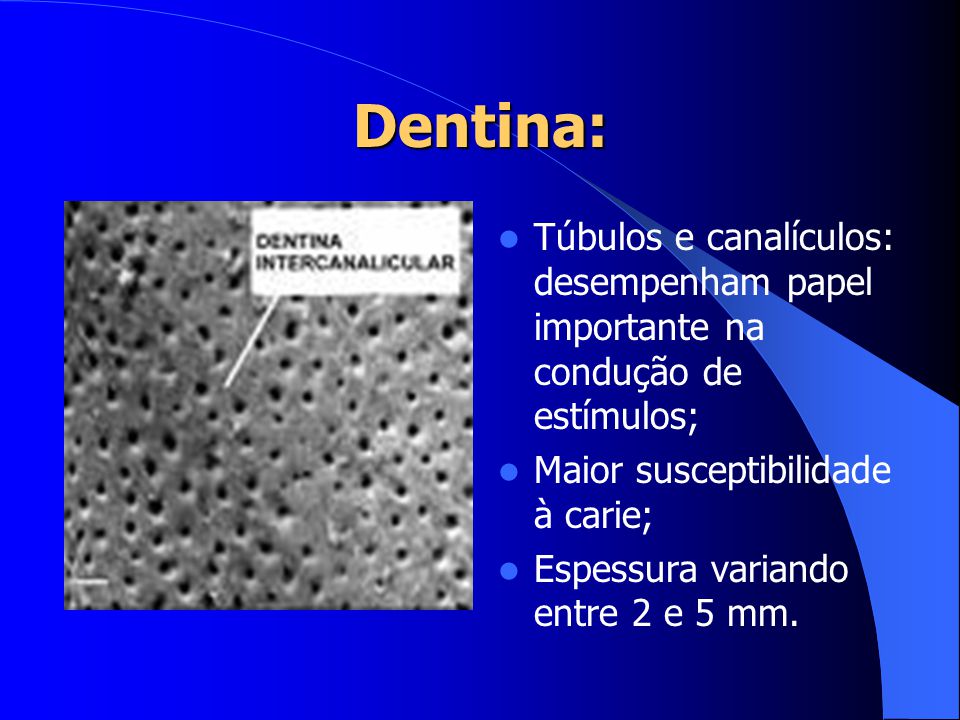 Dentina: Túbulos e canalículos: desempenham papel importante na condução de estímulos; Maior susceptibilidade à carie;