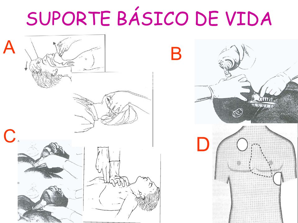 SUPORTE BÁSICO DE VIDA A B C D