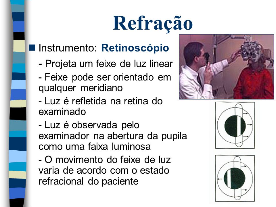 Refração Instrumento: Retinoscópio - Projeta um feixe de luz linear