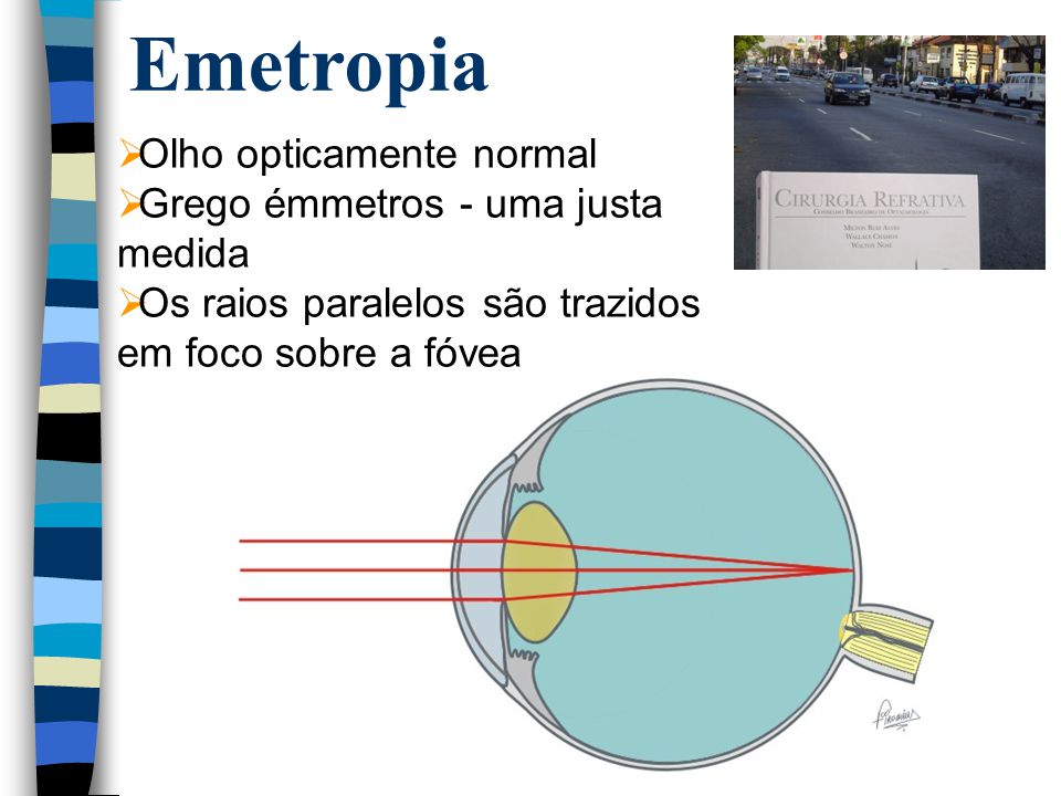 Emetropia Olho opticamente normal Grego émmetros - uma justa medida