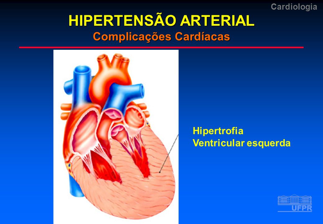 HIPERTENSÃO ARTERIAL Complicações Cardíacas