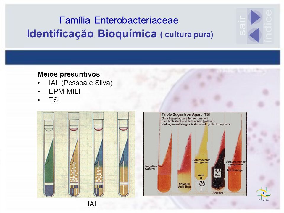 Identificação de Enterobactérias. Dra. Tânia Mara Ibelli Vaz - ppt carregar