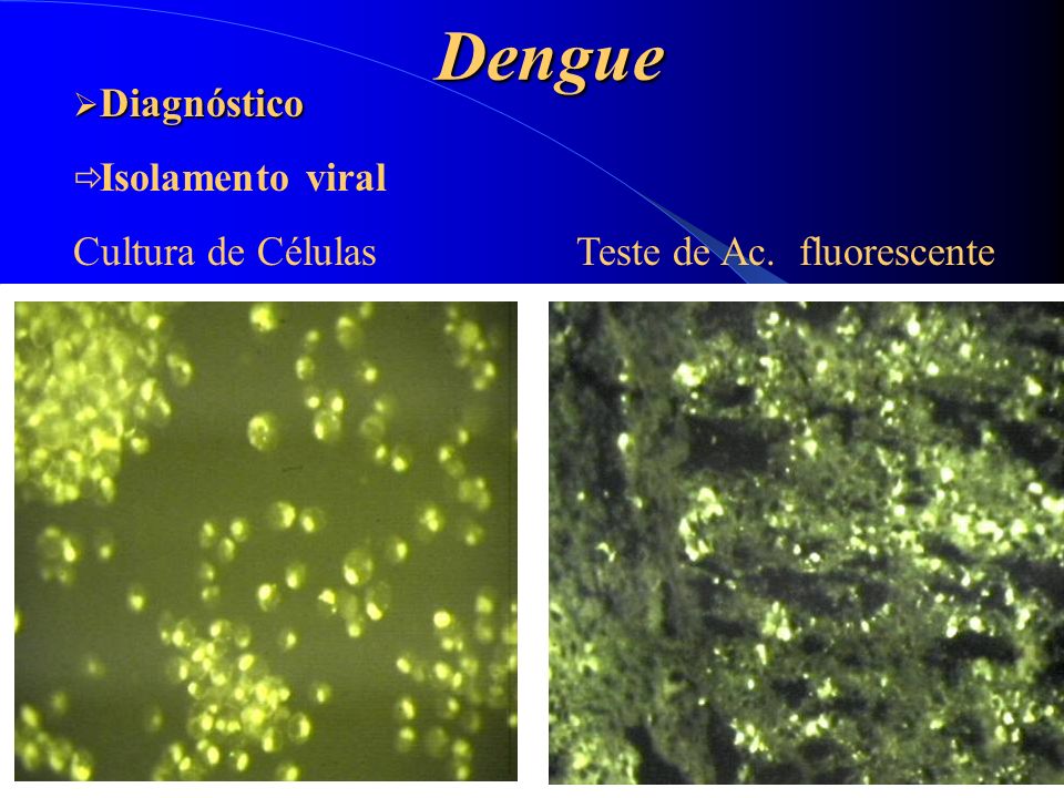 Dengue Diagnóstico Cultura de Células Teste de Ac. fluorescente