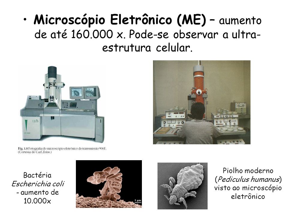 Microscópio Eletrônico (ME) – aumento de até x