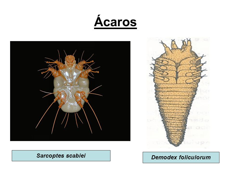 Ácaros Sarcoptes scabiei Demodex foliculorum