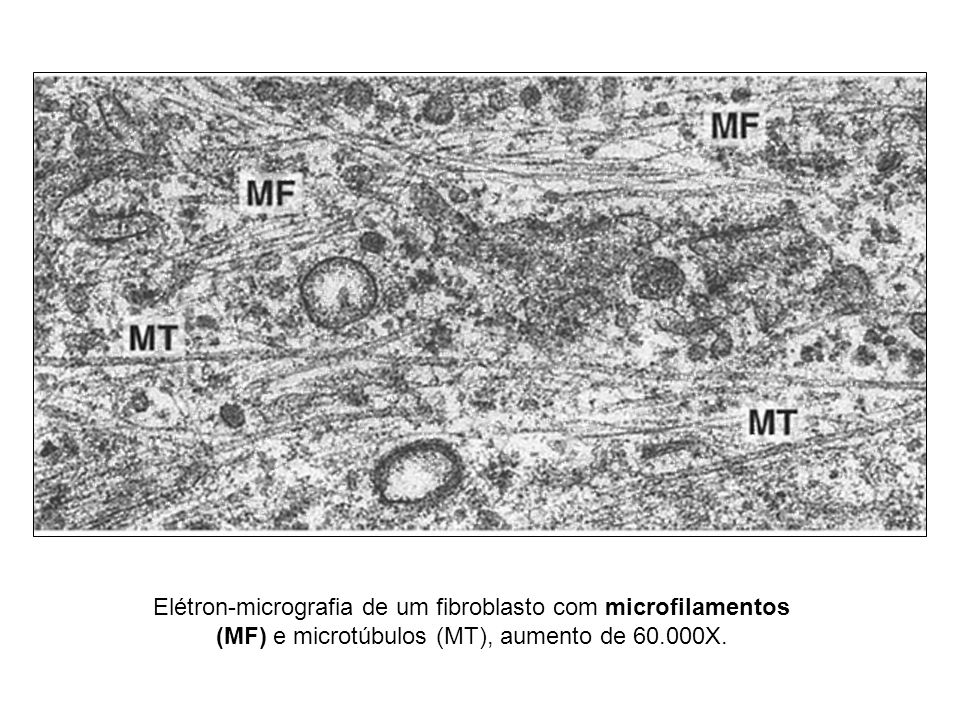 Elétron-micrografia de um fibroblasto com microfilamentos (MF) e microtúbulos (MT), aumento de X.
