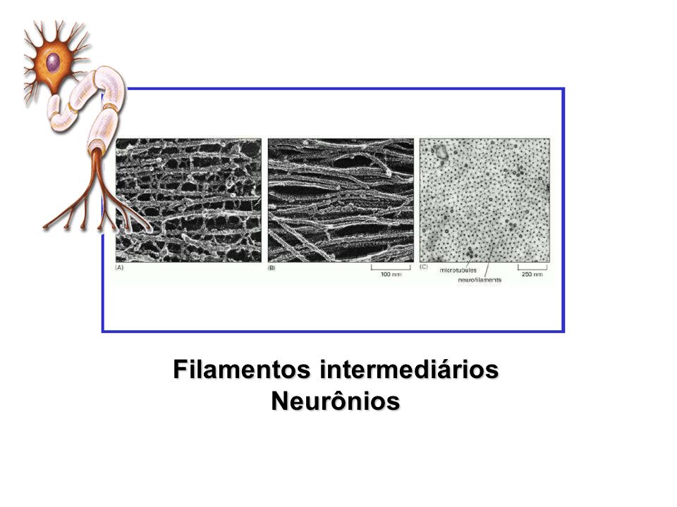 Filamentos intermediários Neurônios