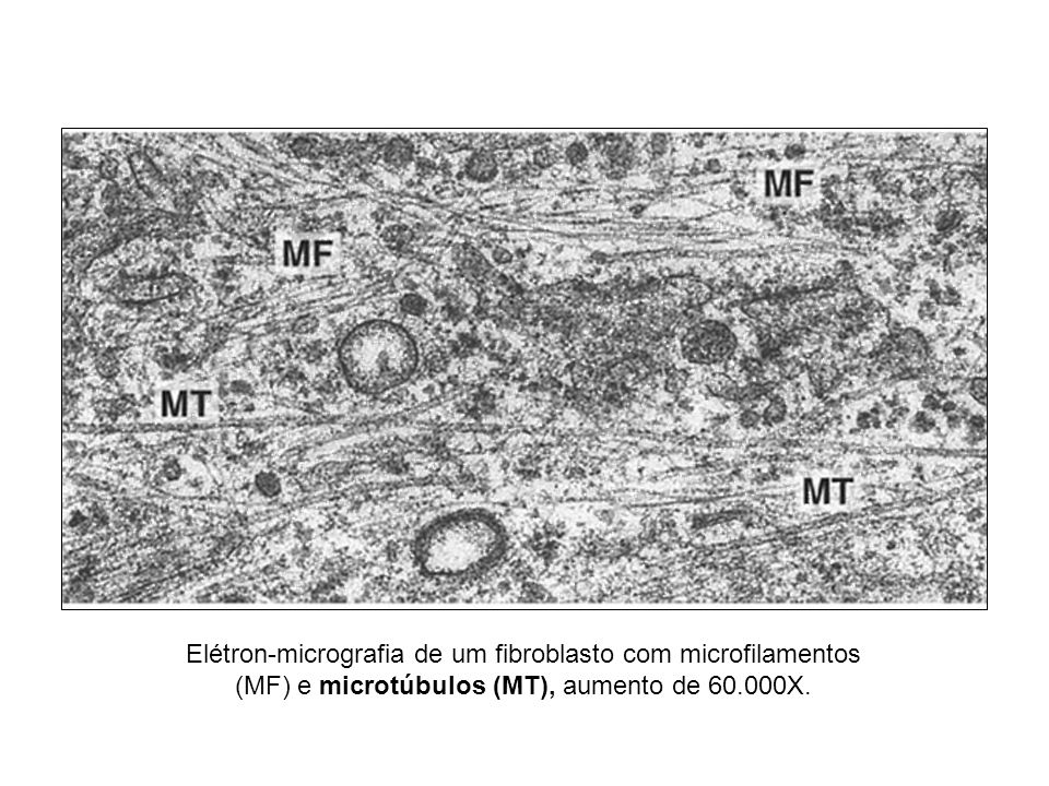 Elétron-micrografia de um fibroblasto com microfilamentos (MF) e microtúbulos (MT), aumento de X.