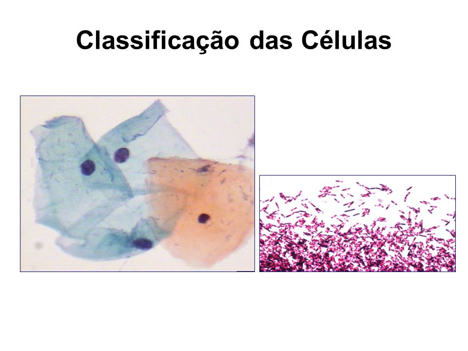 Classificação das Células