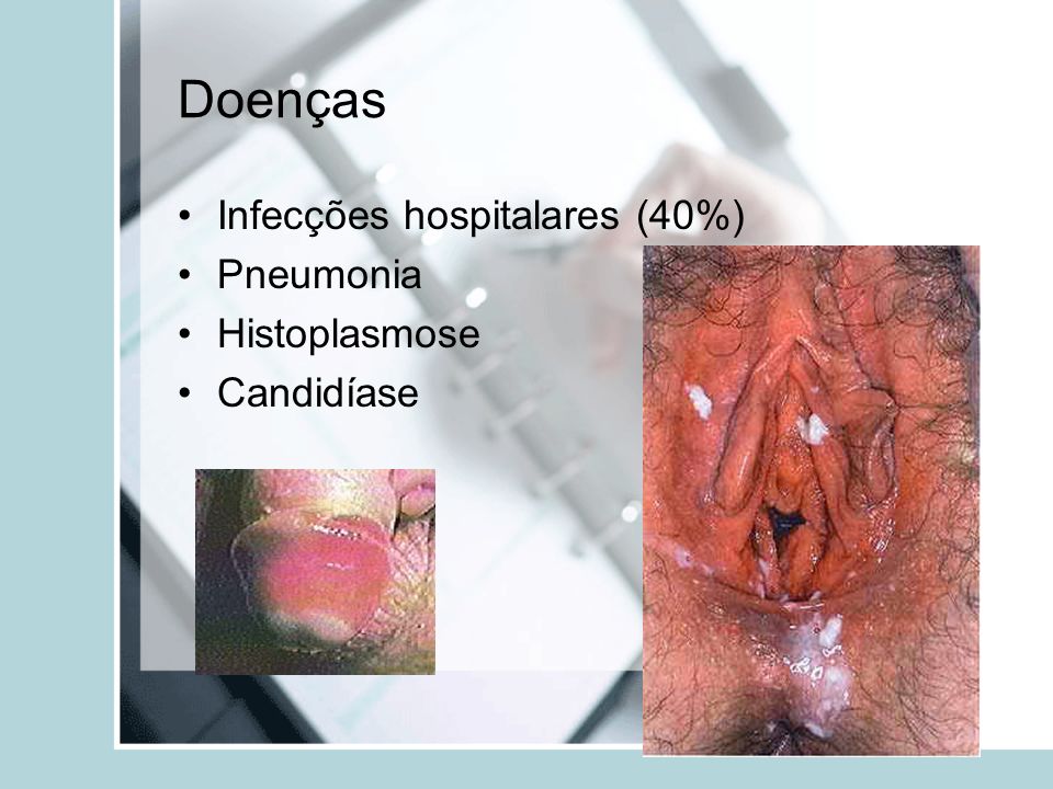 Doenças Infecções hospitalares (40%) Pneumonia Histoplasmose