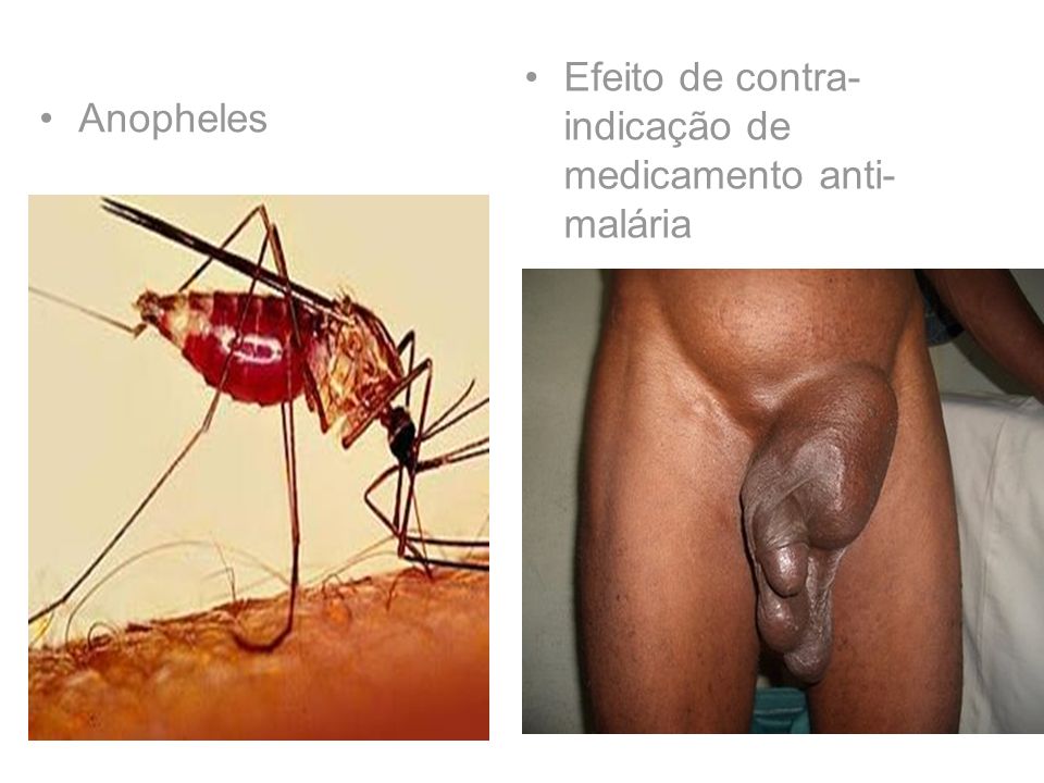 Efeito de contra-indicação de medicamento anti-malária