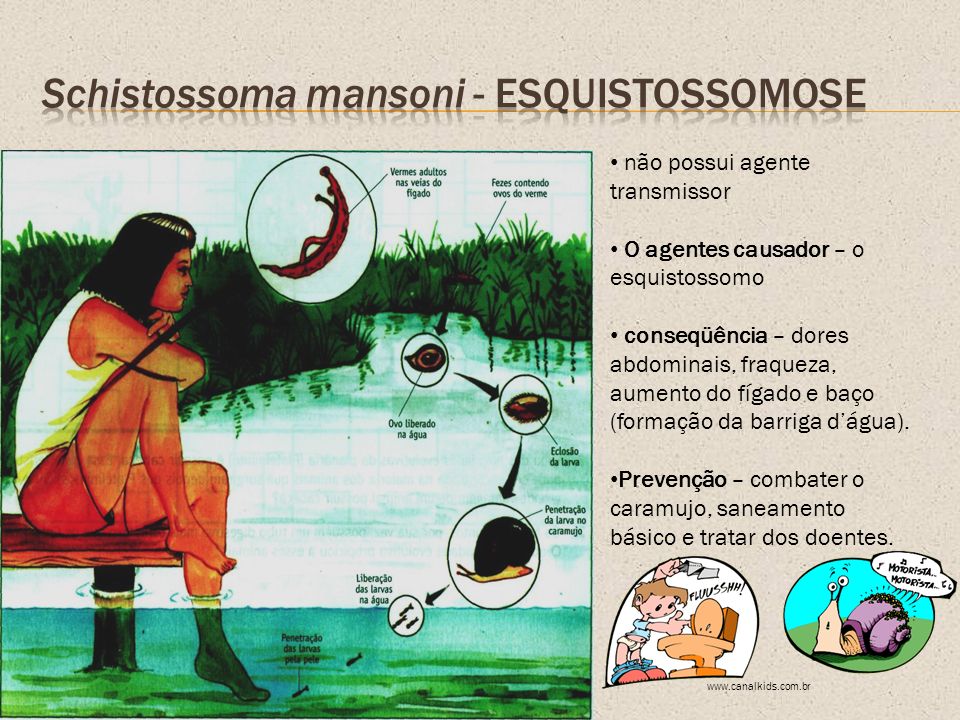 Schistossoma mansoni - Esquistossomose