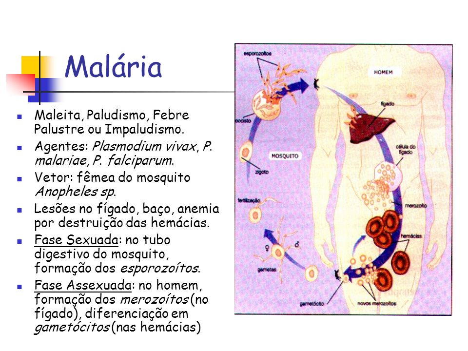 Malária Maleita, Paludismo, Febre Palustre ou Impaludismo.