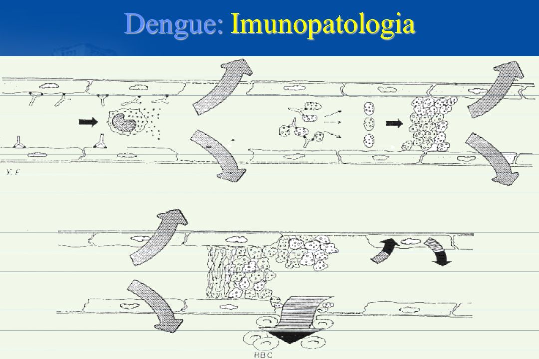 Dengue: Imunopatologia