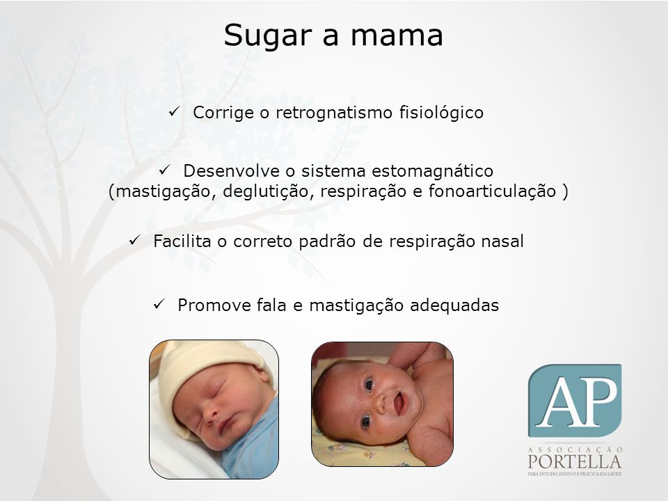 Sugar a mama Corrige o retrognatismo fisiológico
