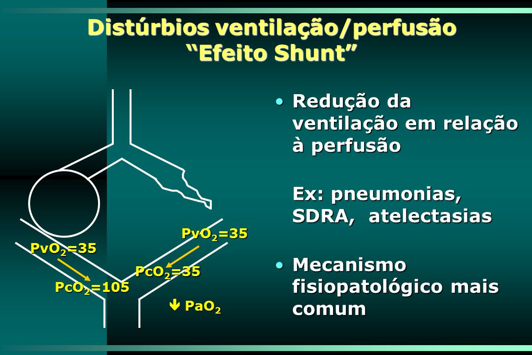 Distúrbios ventilação/perfusão Efeito Shunt