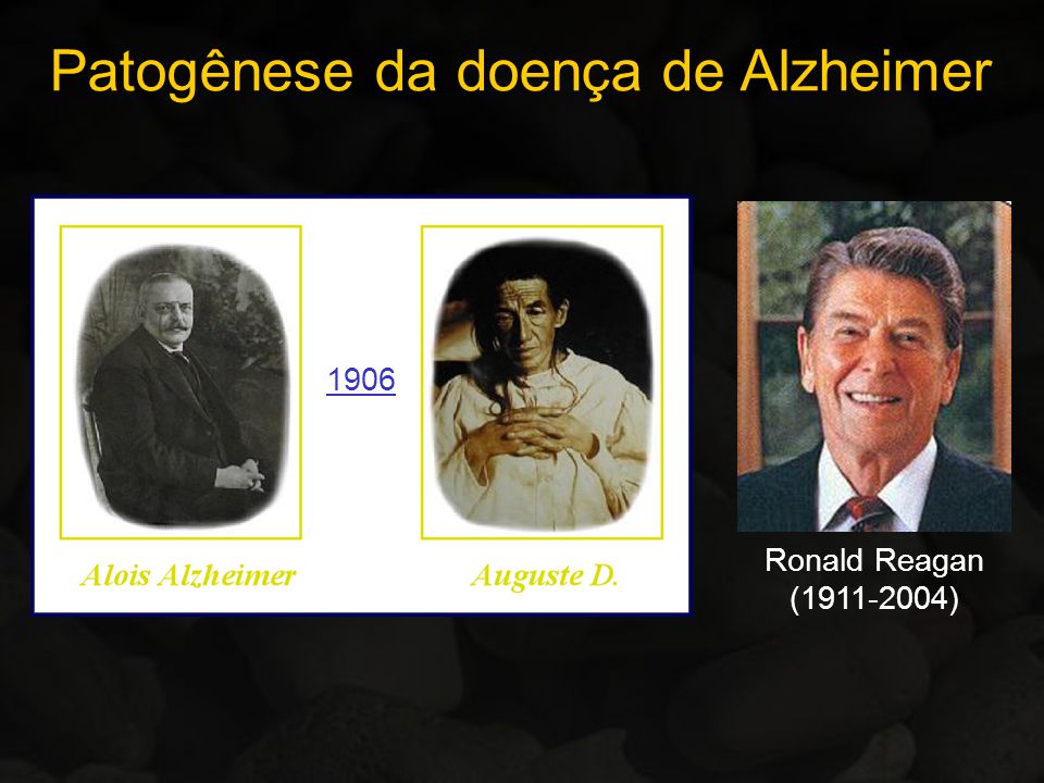 Patogênese da doença de Alzheimer