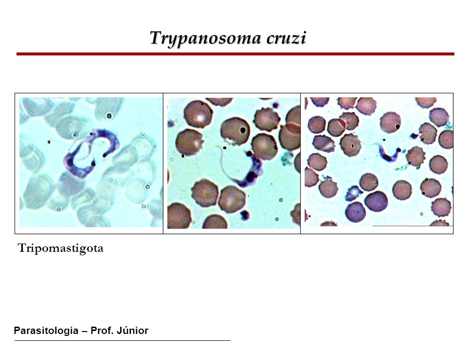 Trypanosoma cruzi Tripomastigota