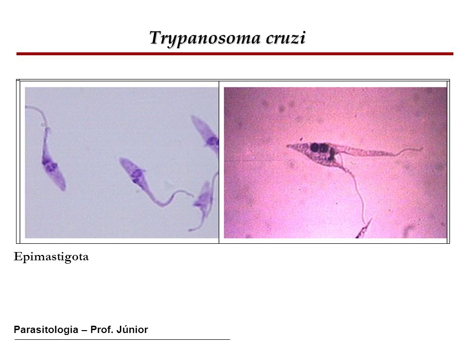 Trypanosoma cruzi Epimastigota