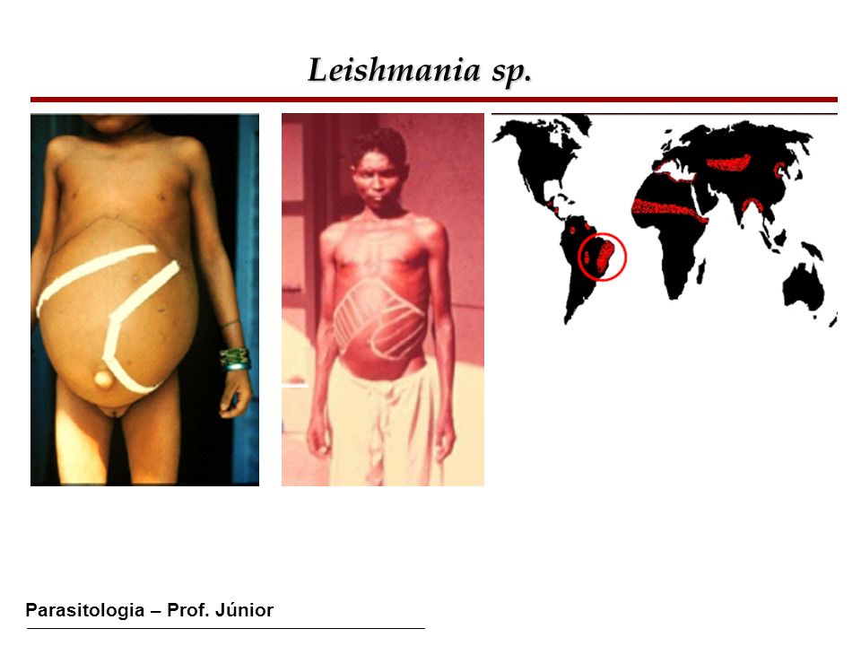 Leishmania sp.