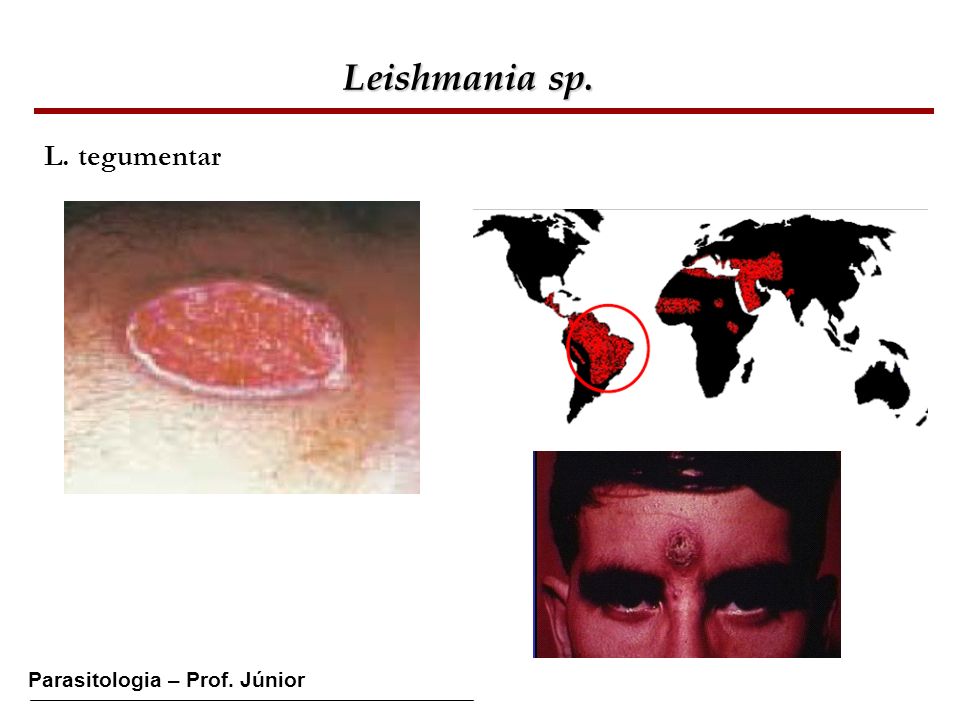 Leishmania sp. L. tegumentar