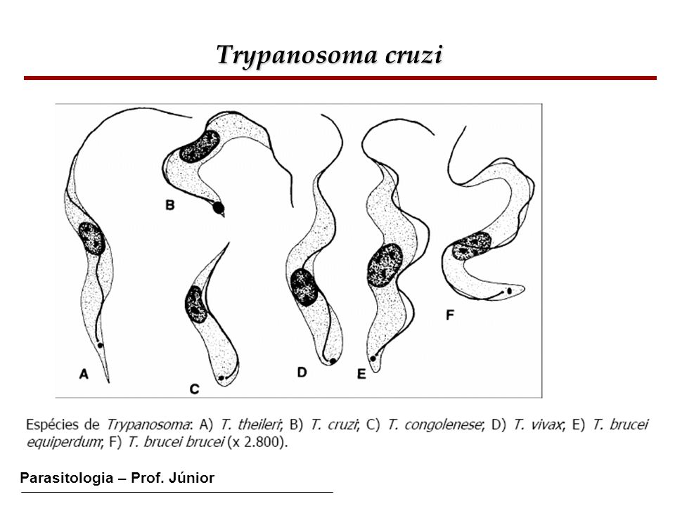 Trypanosoma cruzi